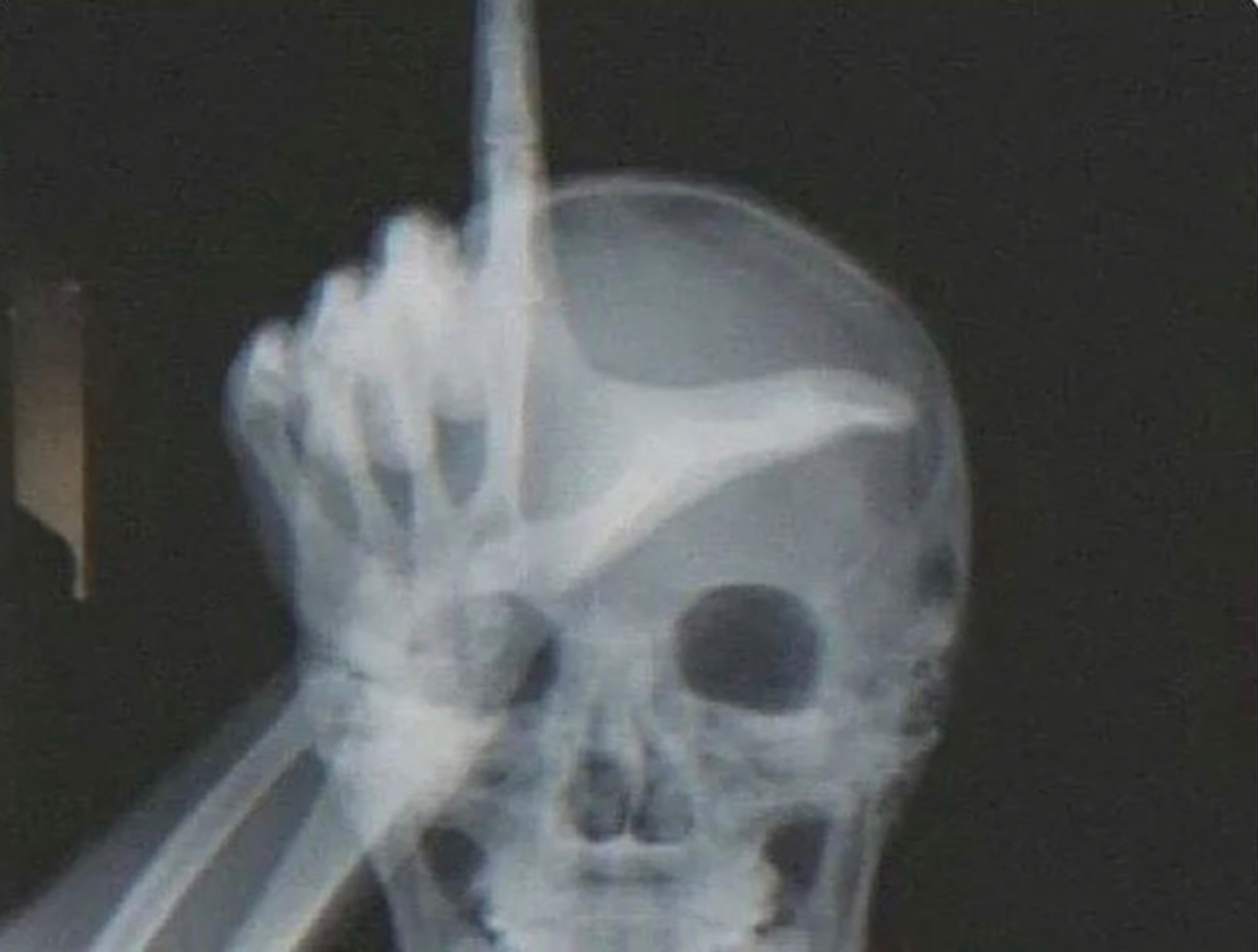 This guy may have a concussion, but the x-ray tech... | Fishbowl